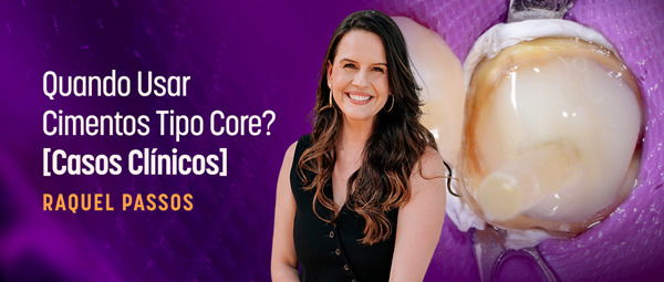 Core Ident Numbers Assista online: Quando Usar Cimentos Tipo Core? - Casos Clínicos | Ident