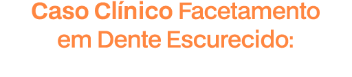 Caso Clínico: Facetamento em Dente Escurecido: Técnica Direta Indireta