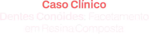 Caso Clinico: Dentes Conóides: Facetamento em Resina Composta