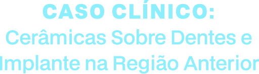 Caso Clínico: Cerâmicas sobre Dentes e Implante na Região Anterior