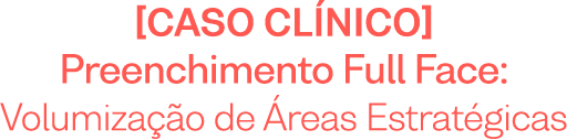 Caso Clínico - Preenchimento Full Face: volumização de áreas estratégicas
