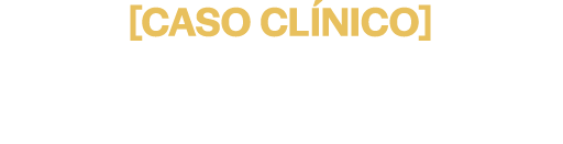 Caso Clínico: Planejamento Cirúrgico para Instalação de Implantes Dentários