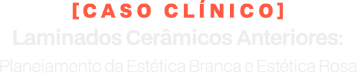 Caso Clínico: Laminados Cerâmicos Anteriores: Planejamento da Estética Branca e Estética Rosa