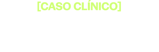 Caso Clínico: Fluxo Digital na Prótese sobre Implante