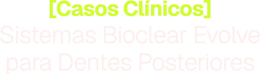 Sistemas Bioclear Evolve para dentes posteriores