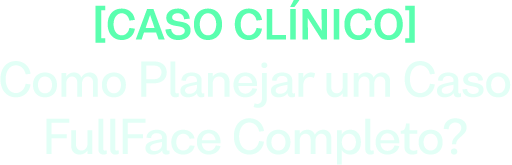 Caso Clínico: Como planejar um caso FullFace completo?
