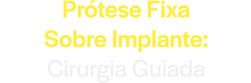 Prótese Fixa sobre Implante: Cirurgia Guiada