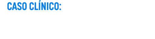 Caso Clínico: Impressão Chairside de Coroa Total com a Midas – Do Planejamento à Entrega Final