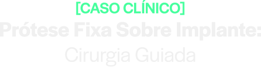 Caso Clínico - Prótese Fixa sobre Implante: Cirurgia Guiada