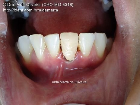 Bomba!!! Urgência de Domingo, Prognóstico Sombrio...