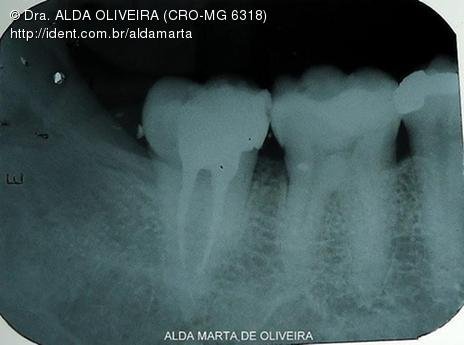 Bio 47 Sessão Única