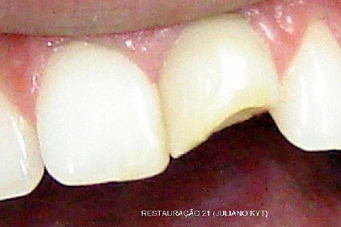 Estou mandando em anexo um arquivo ZIP com algumas fotos.