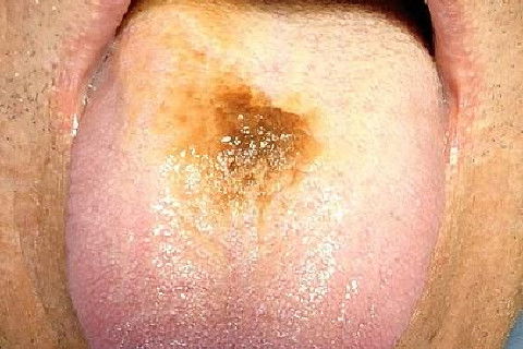 Malefícios do Tabaco!