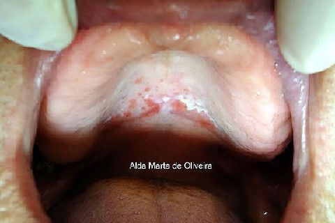 Malefícios do Tabaco!