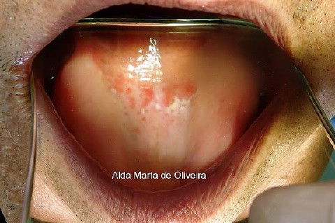 Malefícios do Tabaco!