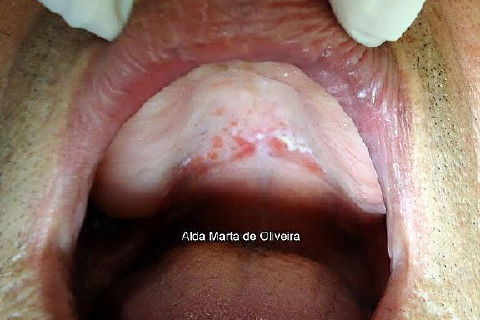 Malefícios do Tabaco!