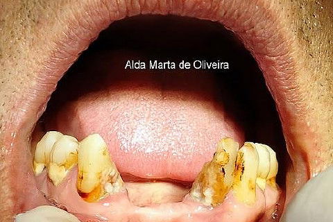 Malefícios do Tabaco!