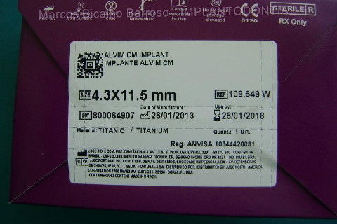 Implante Alvim Cone Morse - Instalação em 20 Minutos, Sem Retalho, Sem Sutura