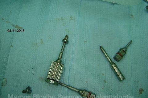 Fase Protética da Reabilitação em Maxila Atrófica