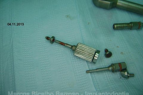 Fase Protética da Reabilitação em Maxila Atrófica