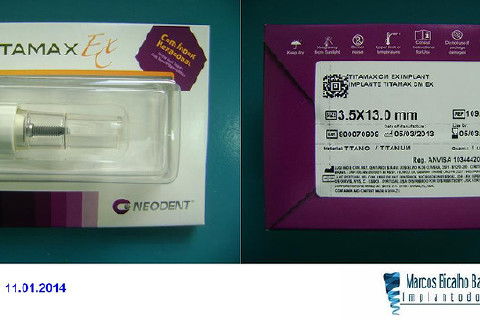 Reabilitação com Implantes em Situações de Colapso Oclusal