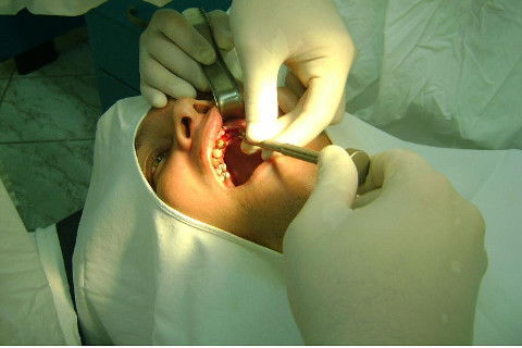 Reabilitação com Implantes em Situações de Colapso Oclusal