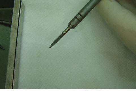 Reabilitação com Implantes em Situações de Colapso Oclusal