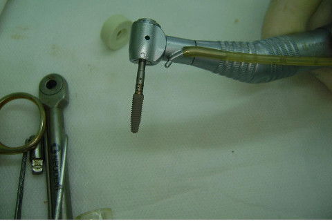 Reabilitação com Implantes em Situações de Colapso Oclusal