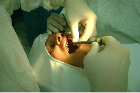 Reabilitação com Implantes em Situações de Colapso Oclusal