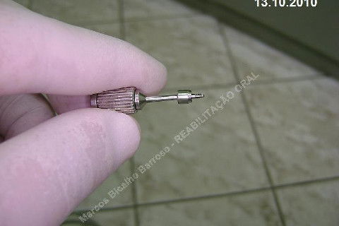 Reabiltiação Oral - 10 Implantes Maxila e Mandíbula - Parte Iv - Reabertura e Instalação dos Cicatrizadores