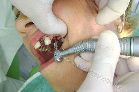 Aqui até que tudo bem, mas nos anteriores, não podia.