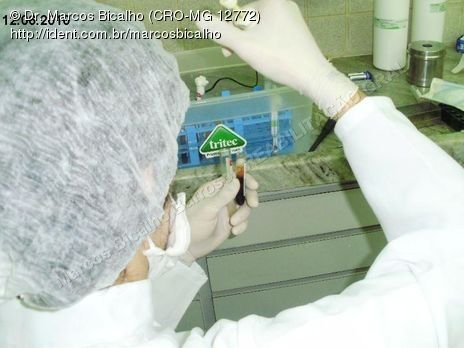 Reabilitação Oral - Parte Iii - Implantes Dentários e Cirurgias Pré Implantodônticas
