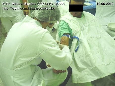 Reabilitação Oral - Parte Iii - Implantes Dentários e Cirurgias Pré Implantodônticas