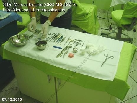 Técnica de Summers com Uso de Prp - Implantes 14,15,16 - Parte Ii - Instalação dos Implantes