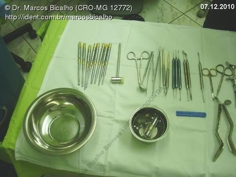 Técnica de Summers com Uso de Prp - Implantes 14,15,16 - Parte Ii - Instalação dos Implantes