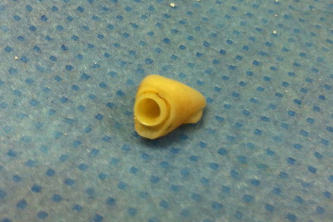 ADAPTAÇAO DO CILINDRO DO MUNHÃO AO DENTE DA PACIENTE