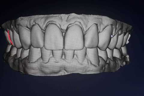 Finalização do planejamento