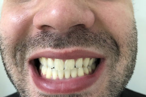 foto inicial do caso