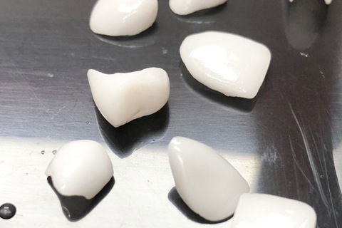 Laminados e Coroa em Emax fresados e com glase