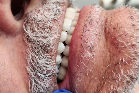 Prova dos Dentes em cera