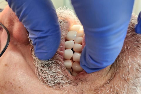 Prova dos dentes em cera