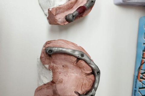 Estruturas metálicas