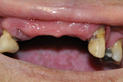 Aspecto clinico sem PPR