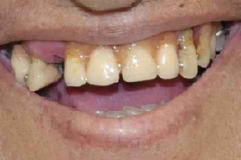 Aspecto clinico com PPR