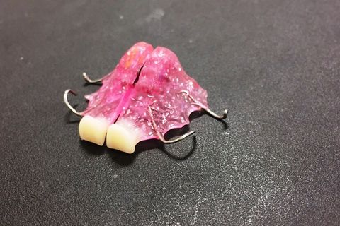 Perda Precoce de Dentes Decíduos; Intervenção Ortopédica Facial.