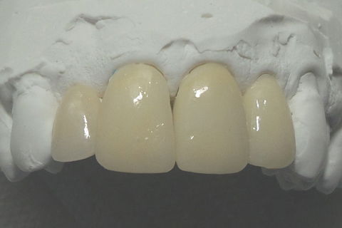 Já adaptado o trabalho sobre modelo