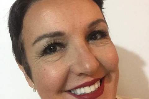 Tratamento Estético com Laminados Cerâmicos Manchamento de Tetraciclina Sem Ortodontia