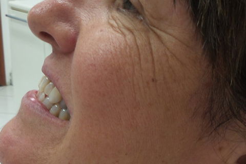 inicial lateral direita