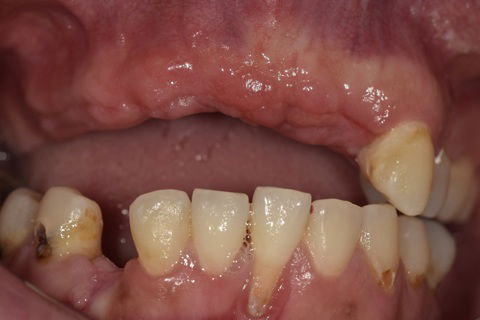 Visão Frontal Pós-Cirúrgica (30 dias)