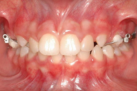 Haas Multifunção 3d, Modificado por Franco E.j